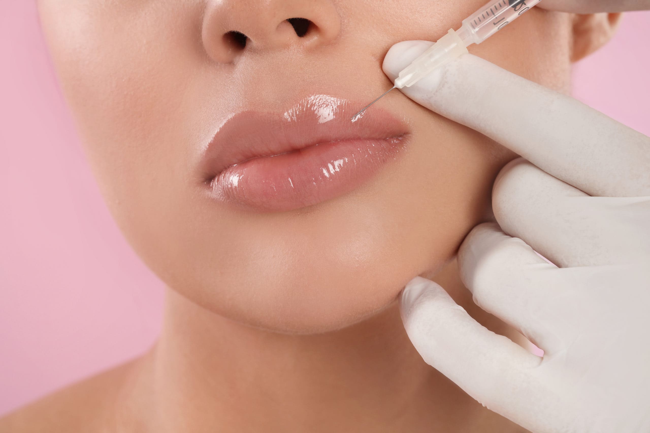 Lip Fillers: What to Expect, Types, Benefits & Side Effects