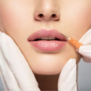 Types of Lip Fillers